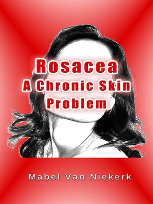 cover image of Rosacea